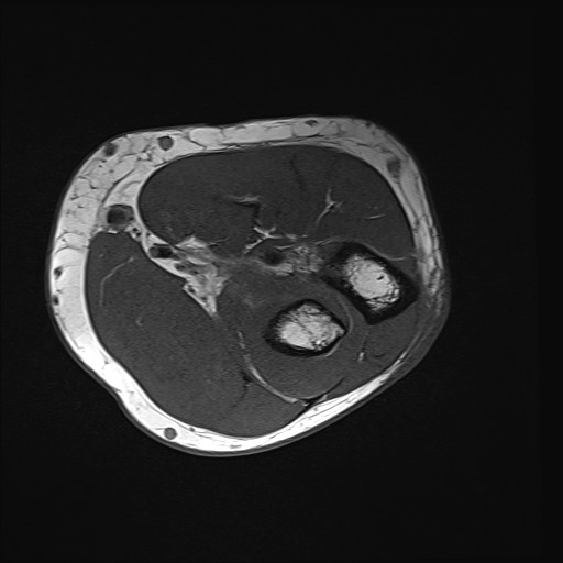 Click on the Serie image to view the images of Wieszt, Gnter